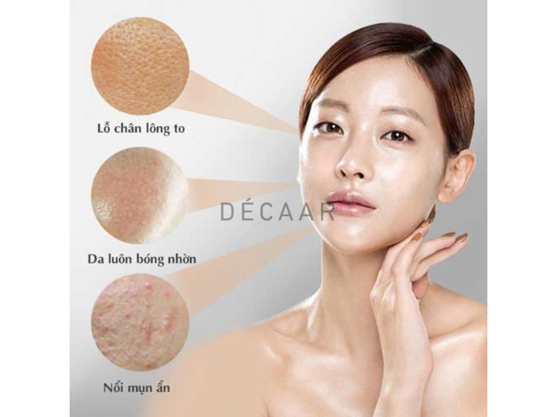 da dầu mụn có nên dưỡng ẩm không